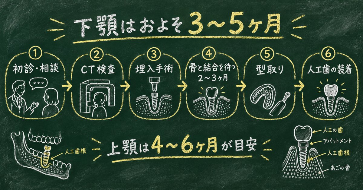 人工歯根治療は何ヶ月かかる？初診から完了までの標準スケジュール