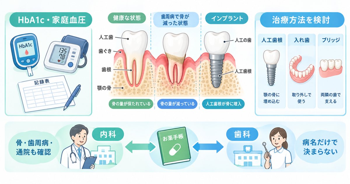 糖尿病・高血圧でも人工歯根はできる？入れ歯との違いと受診の目安