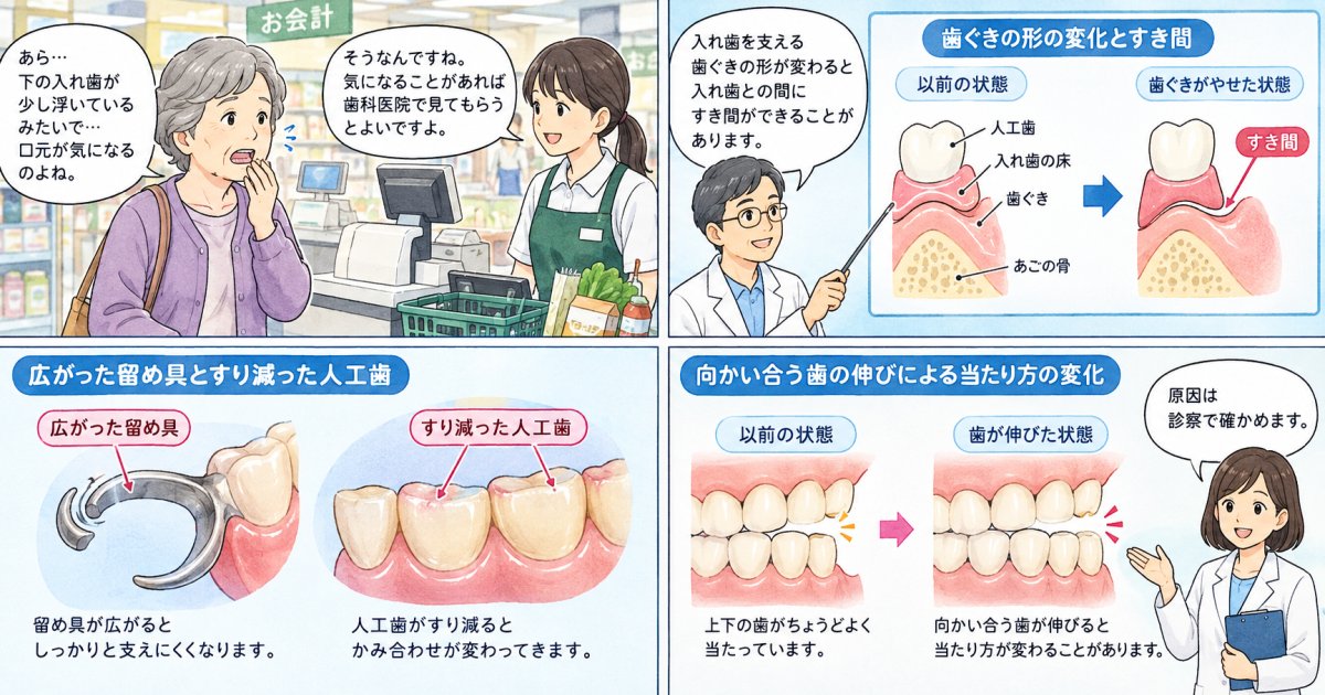 下の部分入れ歯が浮く・落ちる・痛むのはなぜですか？